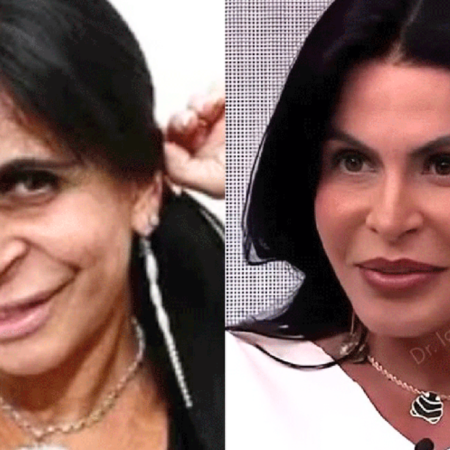 Gretchen rebate críticas sobre procedimentos estéticos e diz que é inveja